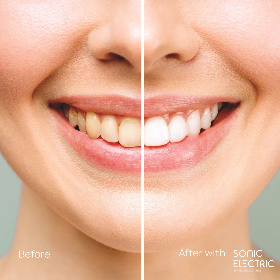 Sonic Electronic Toothbrush (5 Mode) - Image 6