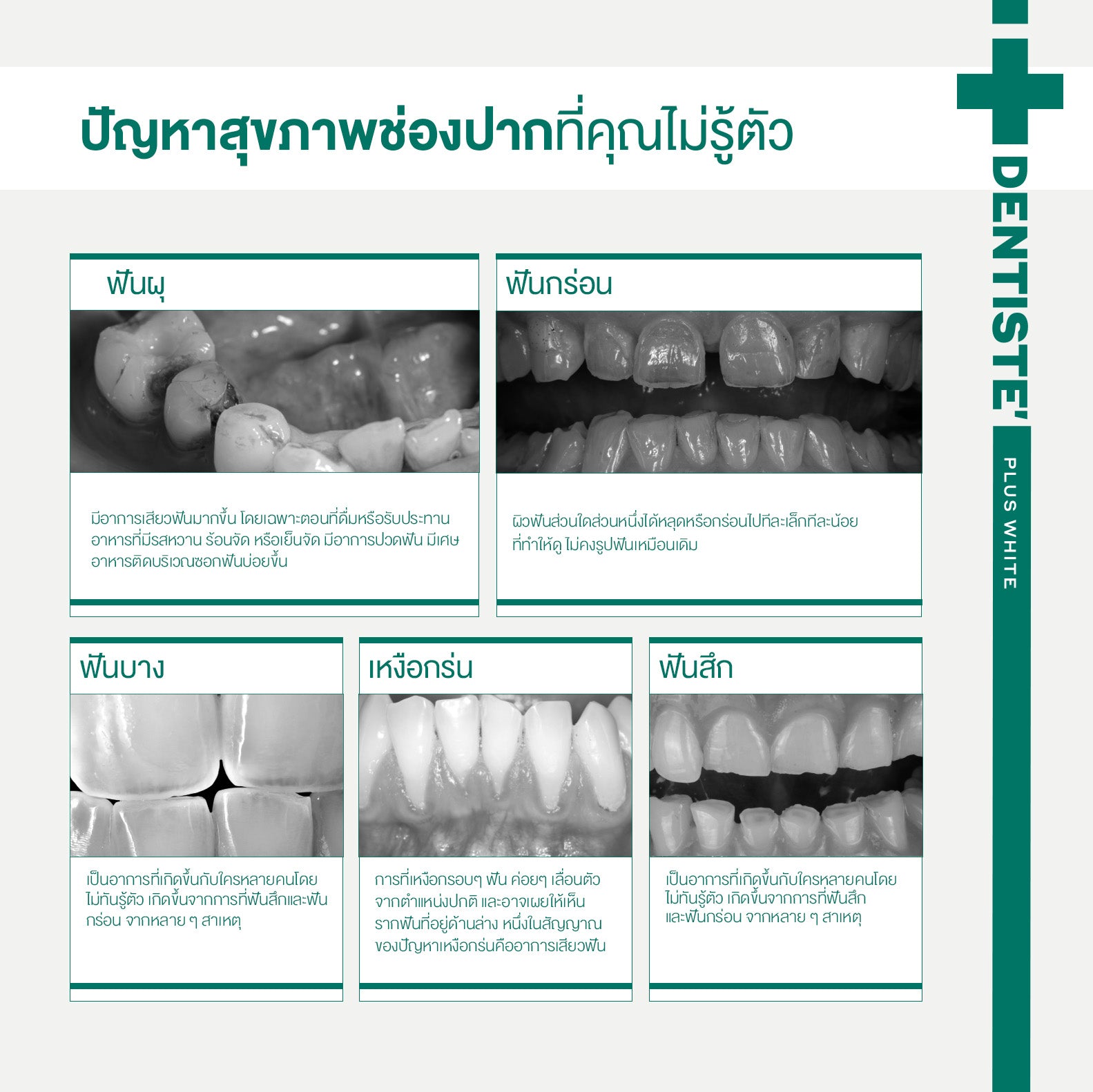 [2 Free 4] Dentiste' Remin Fluoride 15 g. & Repaire X3 70 g. Free! Toothbrush x3 & Magic Brush x1