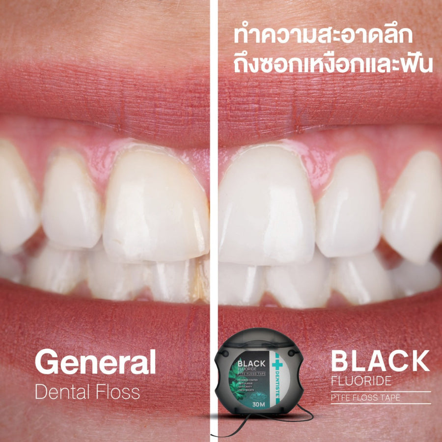 Dental Black Fluoride Floss - Image 7